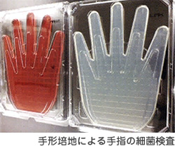手形培地による手指の細菌検査